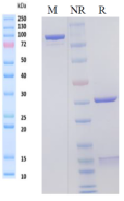 /ueditor/image/20241231/1735615139357698/6ab9ab15fe041ee63709560cdc77f6ae.png image.png