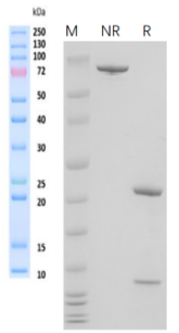 /ueditor/image/20240722/1721618199534772/f9765a07df56504615ffc6679e3f6164.png image.png