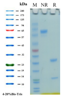 /ueditor/image/20250617/1750143191531263/0e0c2b069f097da3cc0de56f47d824b1.png image.png